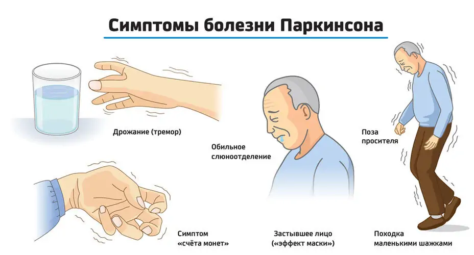 симптомы Паркинсона 